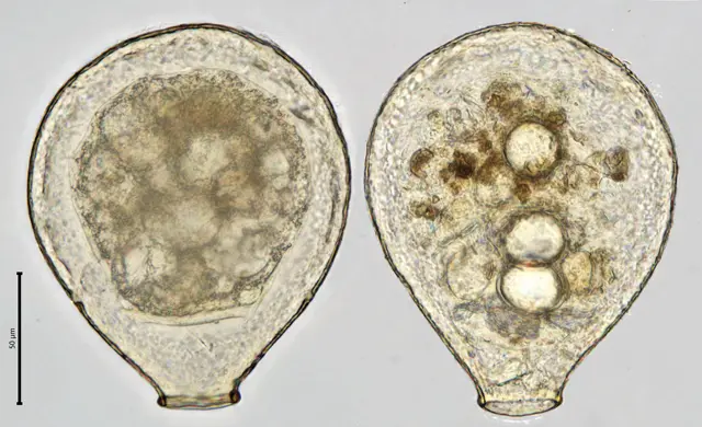 Nebela tincta galeata
